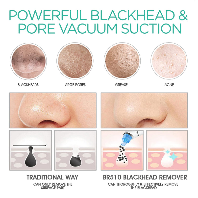 [Australia] - VOYOR Blackhead Remover Vacuum - Electric Vacuum Suction Facial Pore Cleaner Acne Whiteheads Comedone Extractor Kit for Men and Women including 6 Suction Heads and 5 Suction Levels BR510 