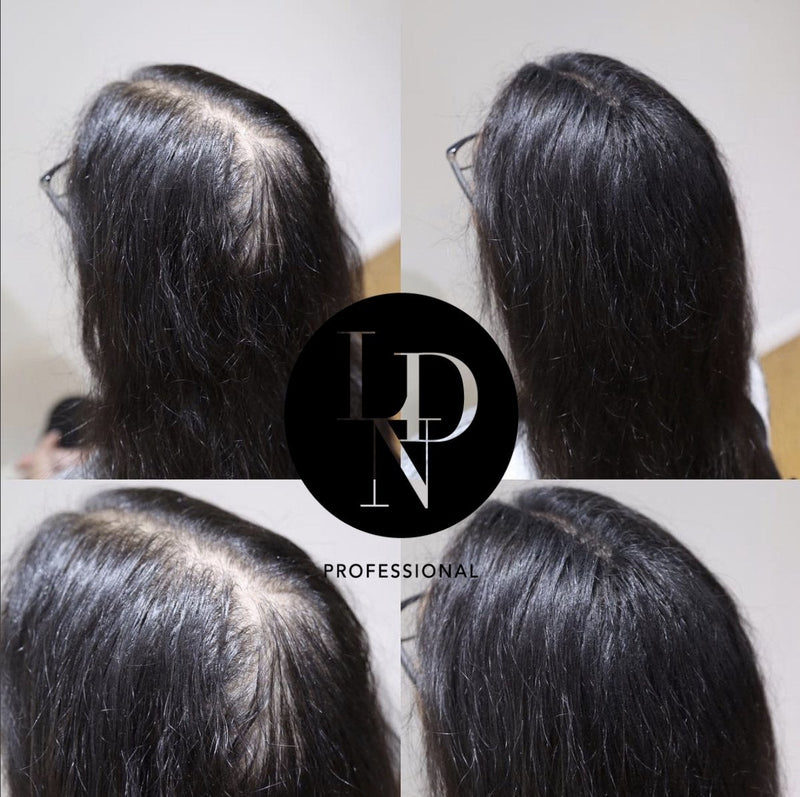[Australia] - LDN Professional Hair Building Fibres - No1. Hair Fibres for Hair Loss and Thin Hair, Instantly Thicken Hair Naturally, 22g hair fiber bottle (Black) Black 