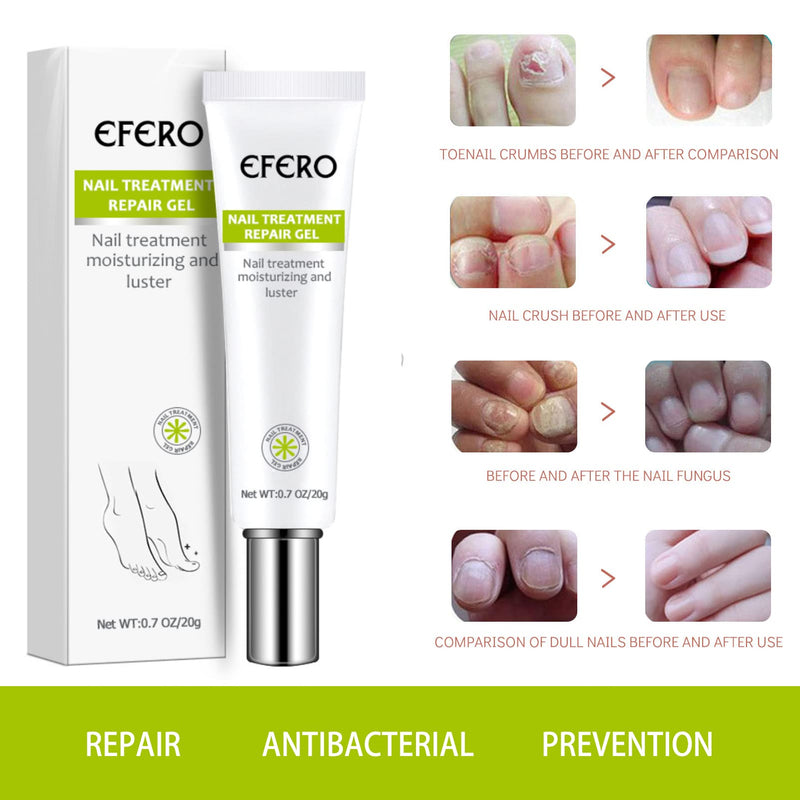 [Australia] - Fungal Nail Treatment, Fungus Nail Cream, Fungal Nail Eliminator for Toenails and Fingernails Strong Anti-Fungal Toenail Cream, Nail Repair Nourishing Treatment 