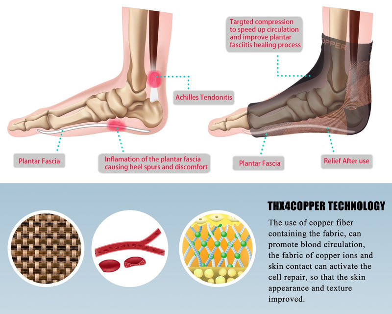 [Australia] - Thx4 Copper Compression Recovery Foot Sleeves for Men & Women, Copper Infused Plantar Fasciitis Socks for Arch Pain, Reduce Swelling & Heel Spurs, Ankle Sleeve with Arch Support-Large Large (1 Pair) 