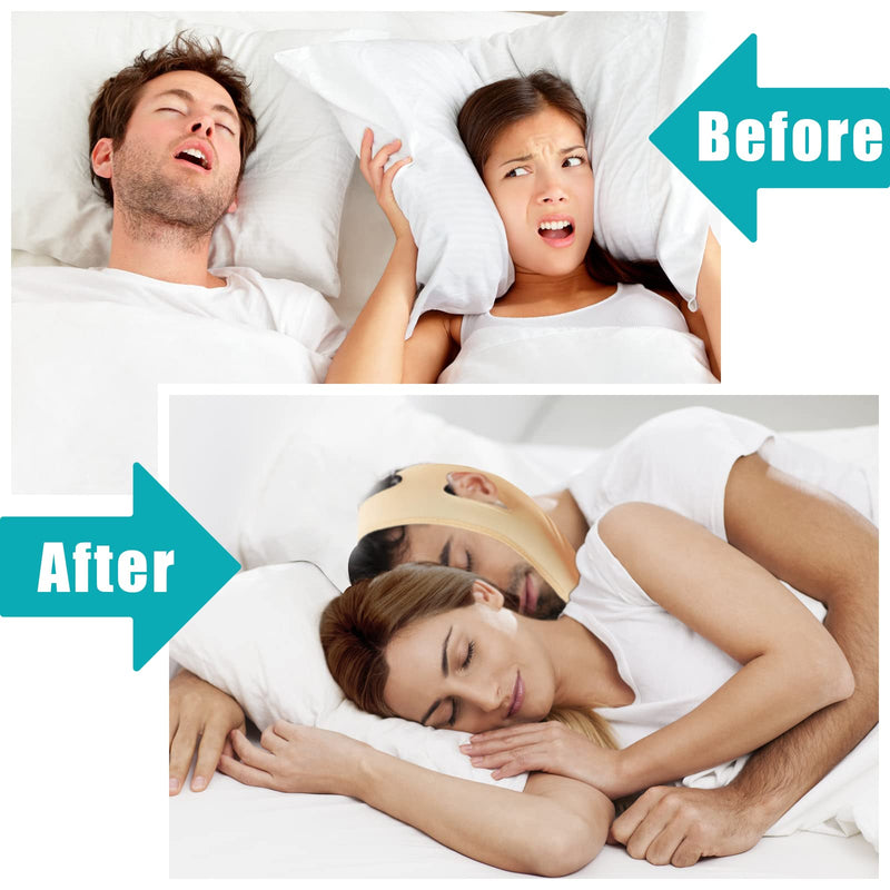 [Australia] - 2Pcs Anti Snore Chin Strap,Comfortable and Breathable Chin Strap to Keep Mouth Closed,Improve Snoring,Chin Strap and Neck Strap Suitable for Women and Men. 
