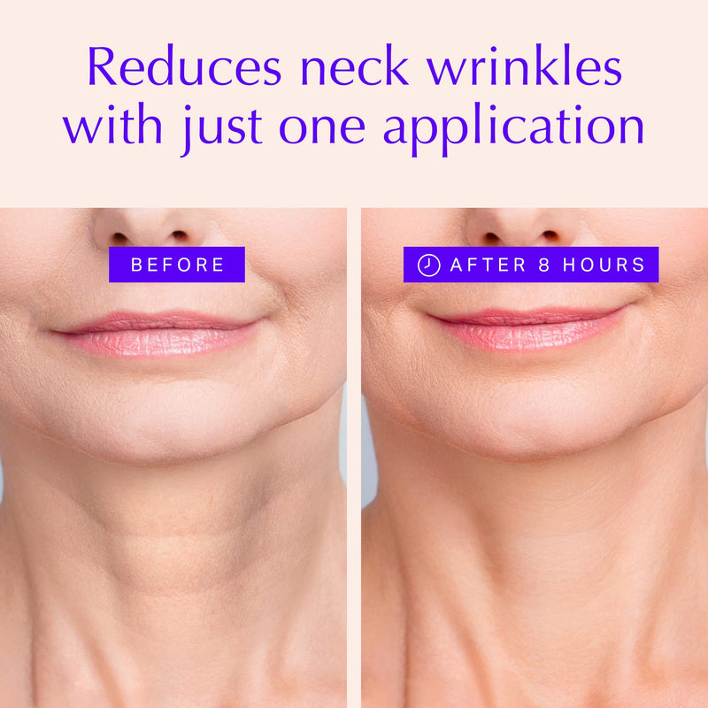 [Australia] - Neck Wrinkle Pads - Anti-Ageing Advanced Neck Firming & Skin Tightening Treatment - Skin-Safe Silicone Skincare Patches - Overnight Reusable Crepe Erase & Neck Lift (1-mo Supply) 2 Neck Pads | Best Seller for Neck Wrinkle Pads 