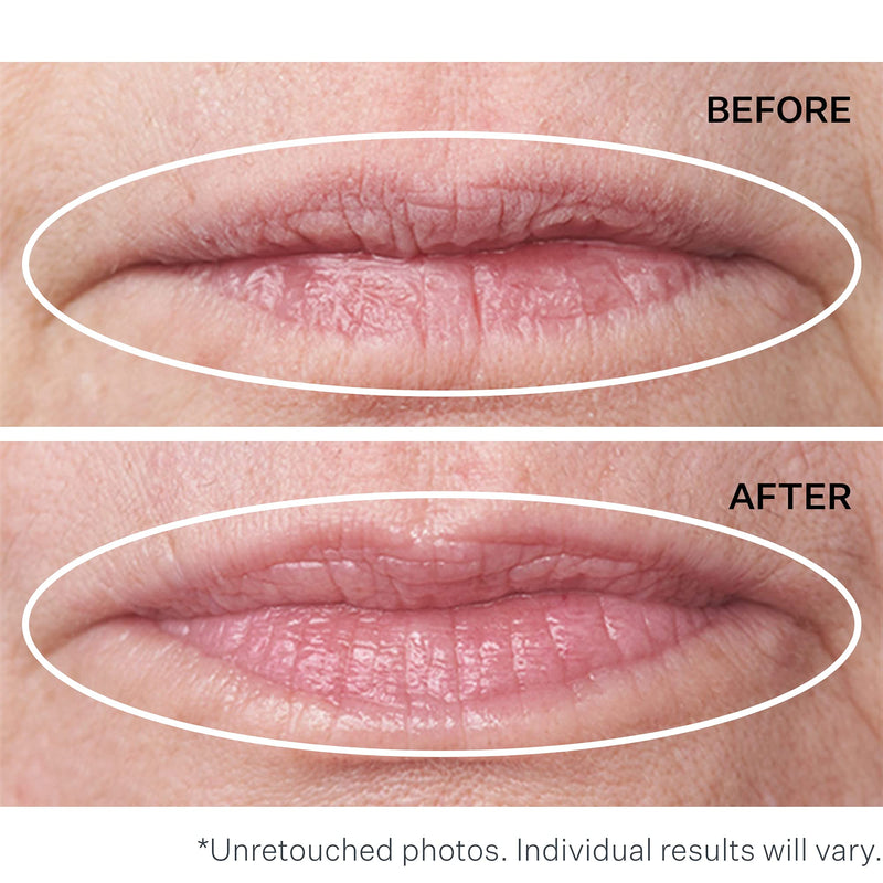 [Australia] - StriVectin Anti-Wrinkle Double Fix for Lips Plump & Smooth Vertical Lines, Hydrating Two-in-One Treatment, 0.16 Fl O 