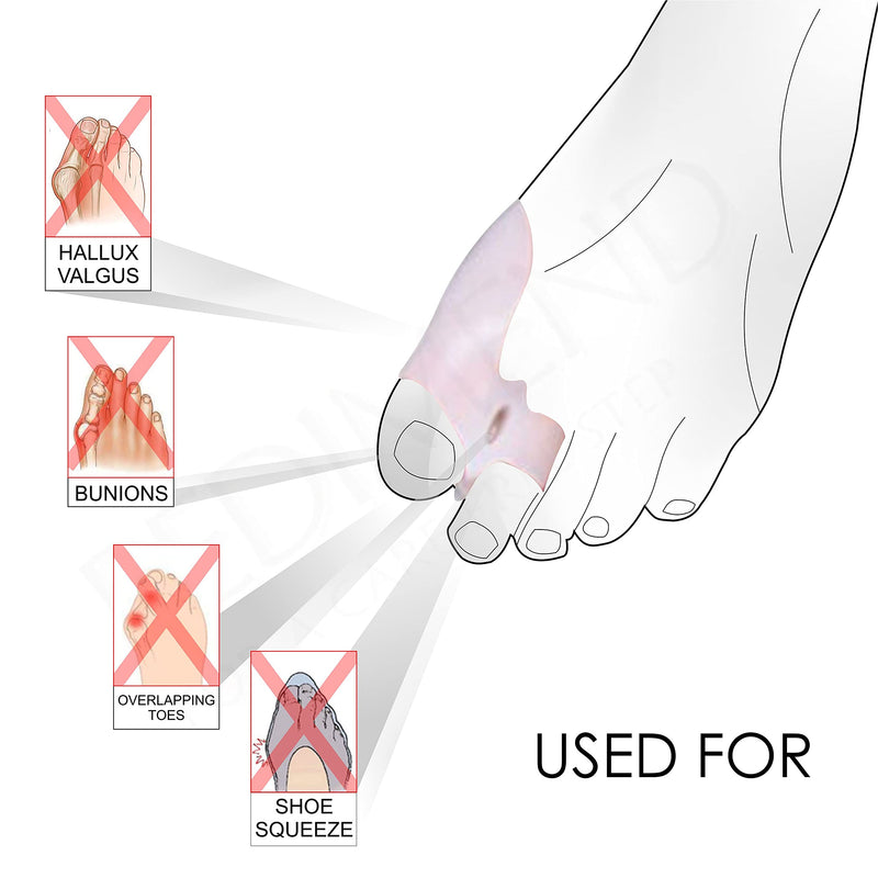 [Australia] - Pedimend Metatarsal Pads for Metatarsalgia Morton's Neuroma & Pedimend Gel Bunion Spacer | Hallux Valgus Deformity Correction Splint | Silicone Big Toe Separator 