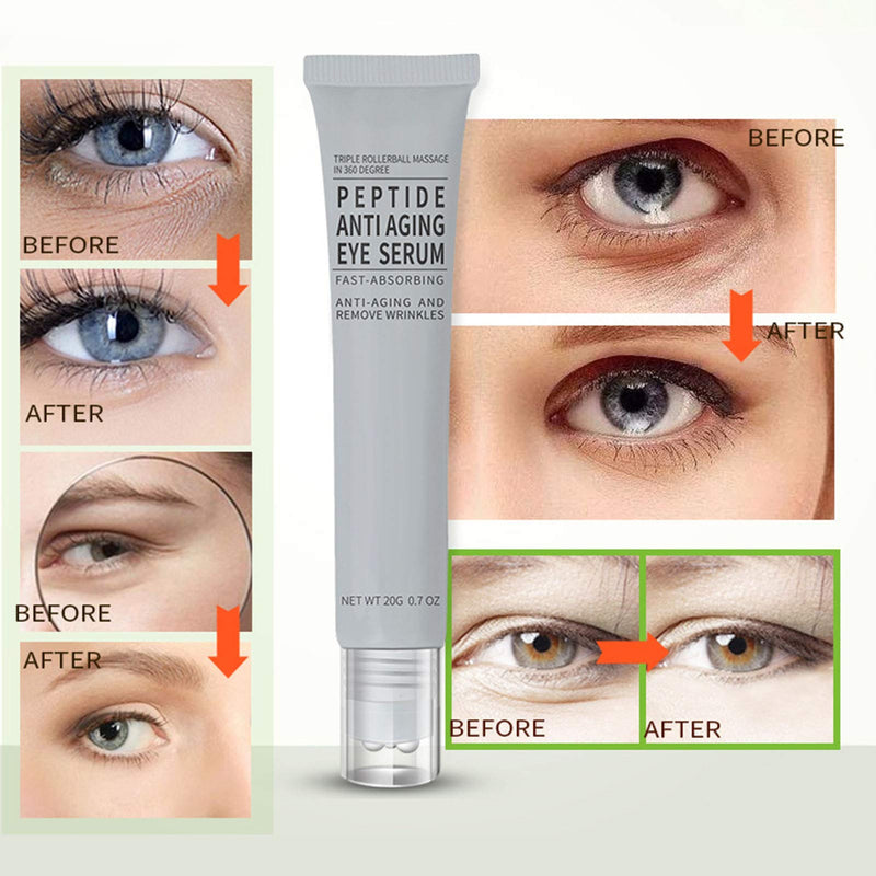 [Australia] - Eye Essence AuQuest 20g Anti-wrinkle Eye Cream Firming Moisturizing Remove Dark Circles Eye Bags Eye Cream 