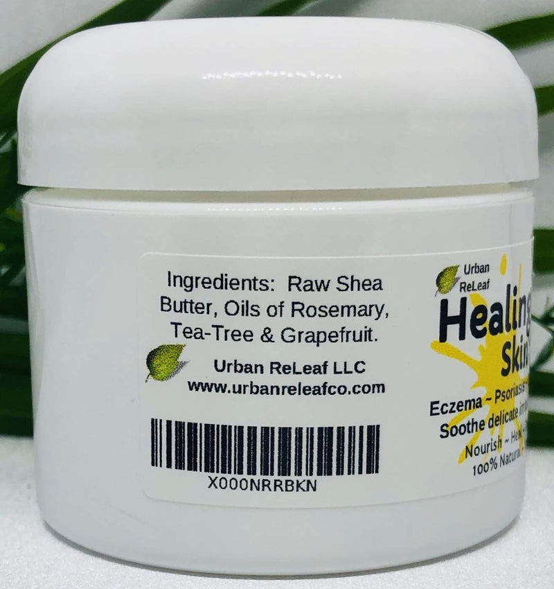 [Australia] - Urban ReLeaf HEALING SKIN SILK, Heals Eczema Psoriasis, Dry Itchy Skin, Nourishing Skin Balm. Rich Shea Butter, Holistic NATURAL Cream. Soothing to body & soul. Healing Essential Oils ! 