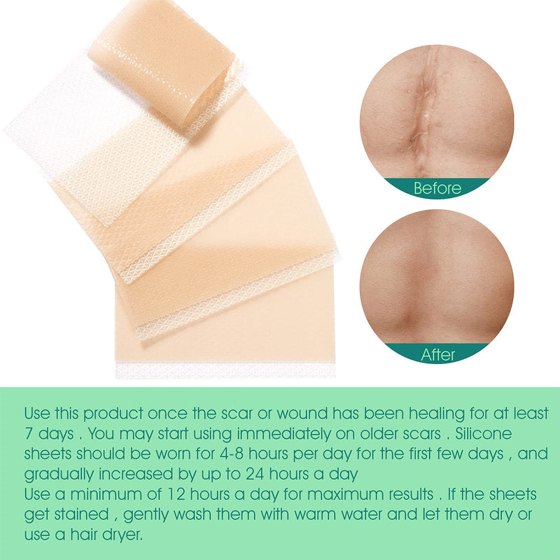 [Australia] - Silicone Scar Removal Leaves, Scar Reduction, Treat New and Old Scars, Quickly and Effectively Removes Scars for Acne Scars, Stretch Marks, Burning, Pack of 4 A 