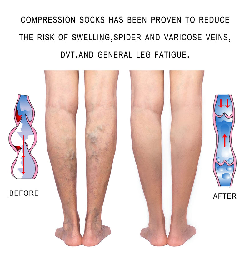 [Australia] - 20-30 mmHg Compression Stockings for Women and Men Knee High Open Toe Beige Small 