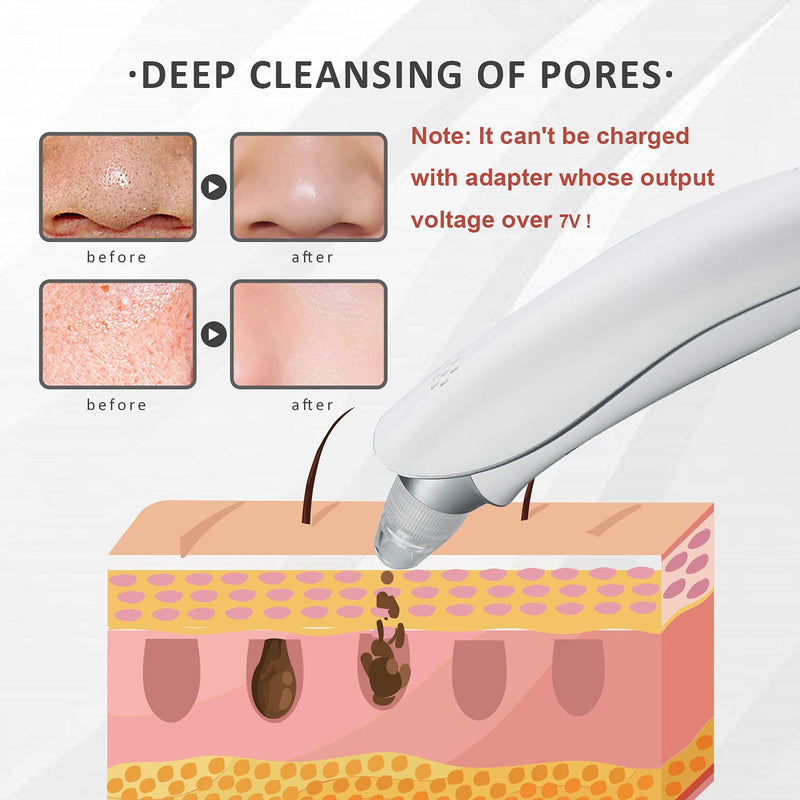 [Australia] - Blackhead Remover Pore Vacuum, 2021 Upgraded Nose and Face Electric Skin Facial Pore Cleanser, LED Display USB Rechargeable Acne Pimple Sucker Tool, Blemish Extractor Comedones Removal for Men & Women 