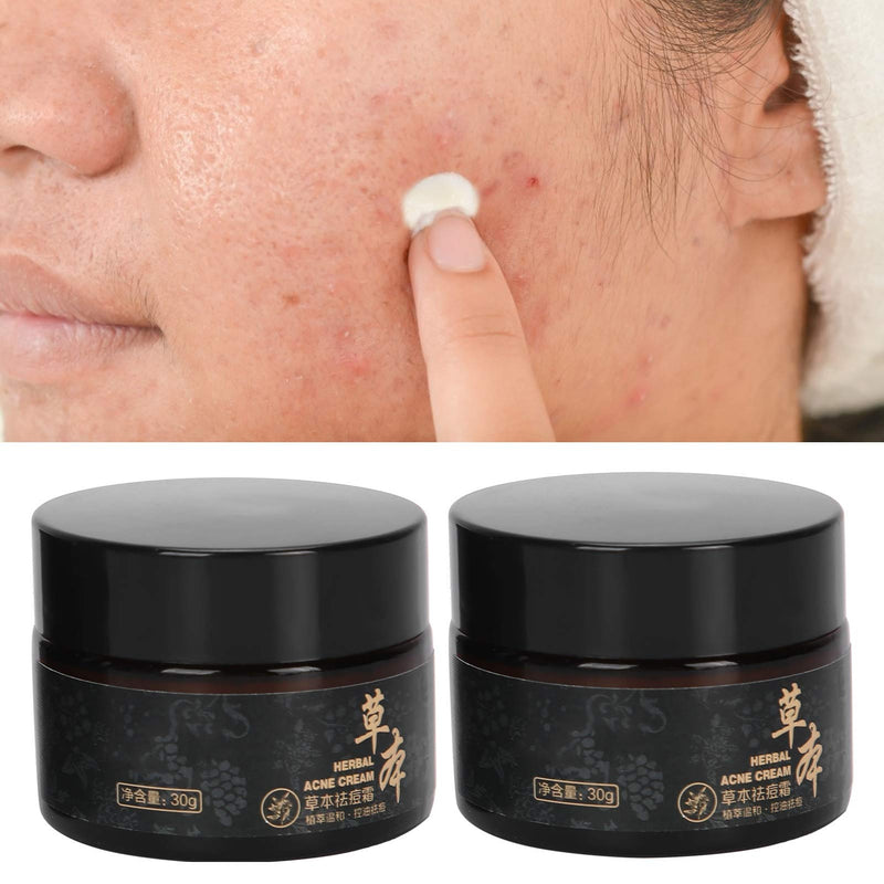 [Australia] - Herbal Acne Cream, Control Oil Remove Acne, Anti‚ÄëAcne Soothing Repairing Face Cream 