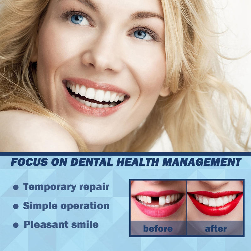 [Australia] - Temporary Tooth Filling, Thermal Forming False Teeth, Tooth Repair Kit DIY Moldable Fake Teeth Repair Beads for Temporary Fixing, Dental Tooth Filler for Missing Broken Fake Chipped Teeth (30ml) 