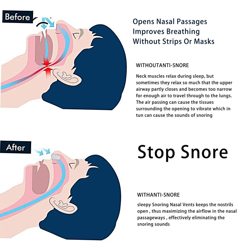 [Australia] - Yuzhou 16 PCS Silicone Nose Vents, Nasal Breathers Anti Snoring Clips Nasal Dilators Breathing Nose Relief Nasal Dilator Snore Stopper Nose Vents Snoring Aids Nose Vents Anti Snore Devices 
