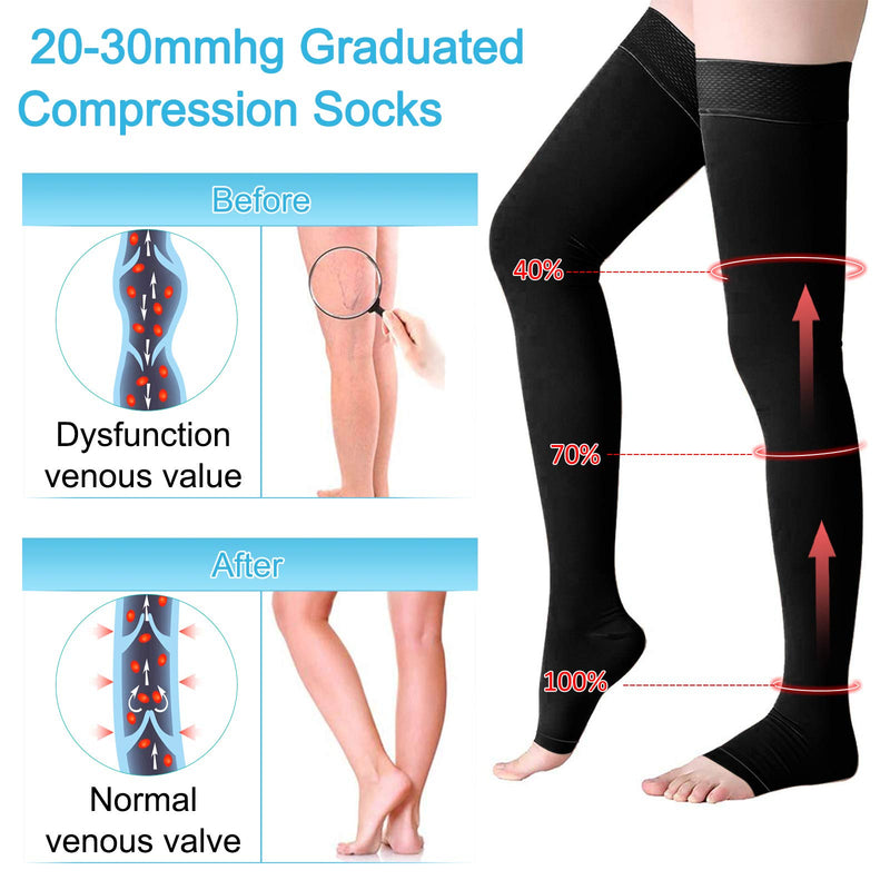 [Australia] - Compression Stockings Thigh High for Women Men 20-30 mmhg Graduated Compression Socks Open Toe Compression Support Hose with Non-Slide Silicone Dot Band for Swelling and Varicose Veins (Black,L) Black Large (1 Pair) 