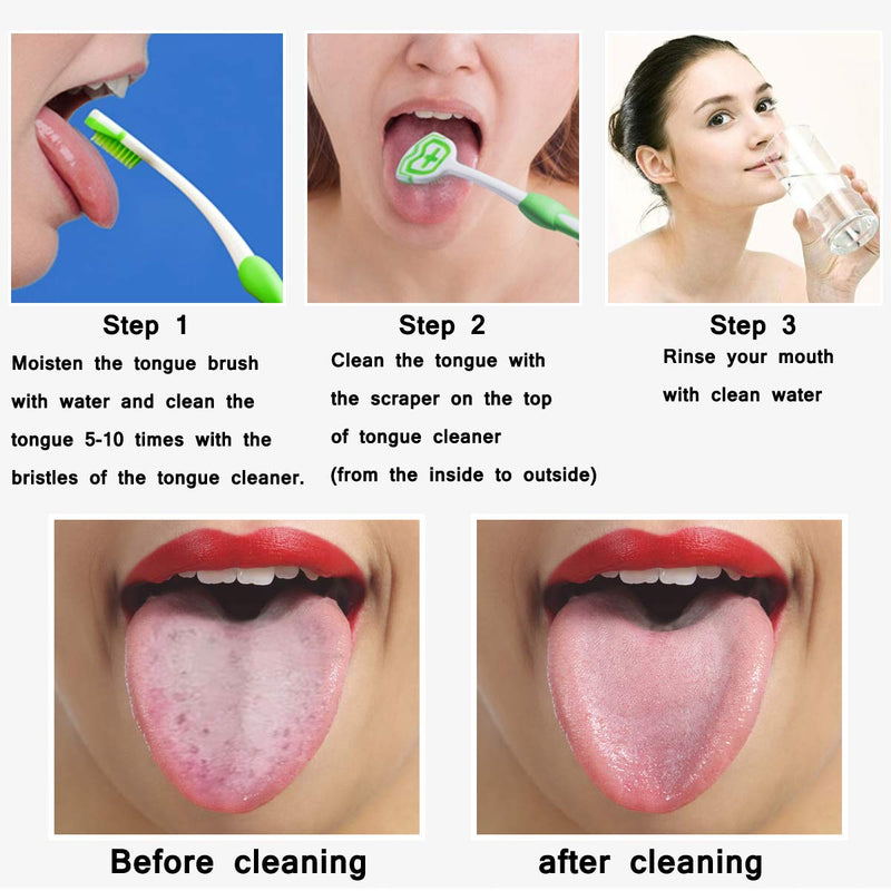 [Australia] - Tongue Brush, Tongue Scraper, Tongue Cleaner, Tongue Brushes Helps Fight Bad Breath, 3 Tongue Scrapers (Blue&Green&Red) Blue&green&red 