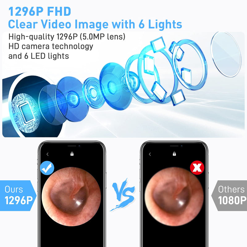 [Australia] - AWELOR Ear Wax Removal Ear Cleaner with Camera,1296P HD Endoscope Earwax Remover Tool with 6 LED Lights,Wireless Ear Otoscope Ear Cleaning Tool for iPhone, iPad & Android Smart Phones 
