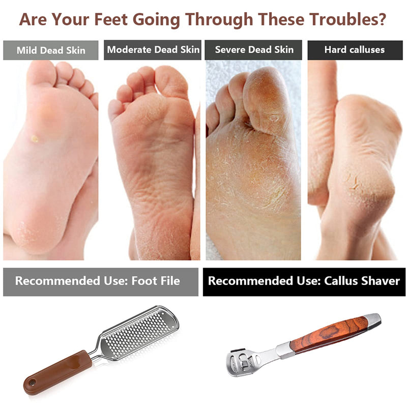 [Australia] - Colossal Foot Rasp & Wood Handle Callus Shaver (10 Replacement & 1 Foot File Heads), Pedicure Foot File Kit, Heel Scraper For Feet, Foot File Callus Remover 