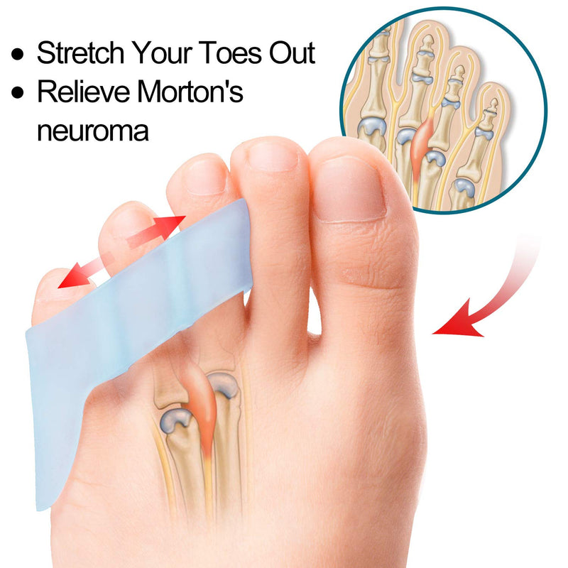 [Australia] - Povihome 10 Pack Pinky Toe Separator and Protectors, Toe Separators for Overlapping Toe, Curled Pinky Toes Separate and Protect - Spacers for Morton's Neuroma Pain Relief 