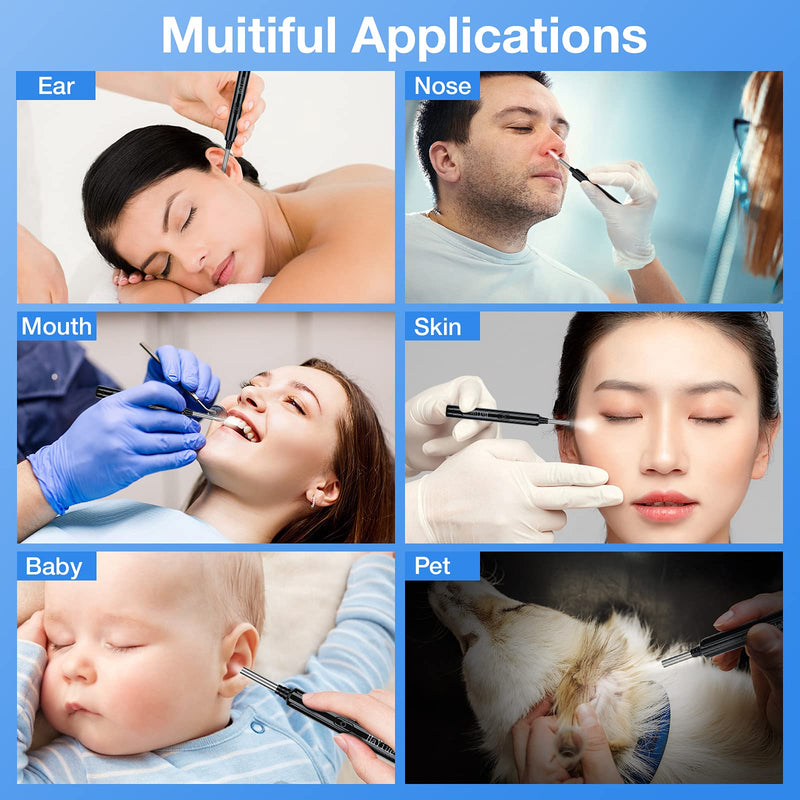 [Australia] - Ear Wax Removal with Camera, Earwax Remover Tool, 1296P FHD Wireless Ear Otoscope with 6 LED Lights, 6 Ear Spoon & 6 Traditional Tools Ear Wax Removal Kit for iPhone, iPad & Android Smart Phone Black 