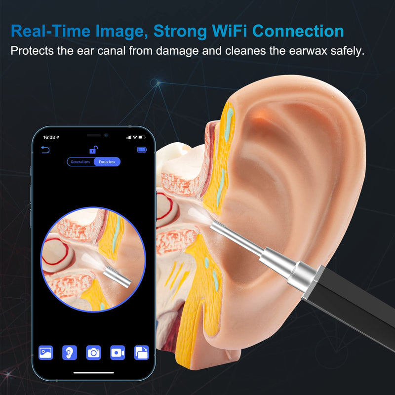 [Australia] - Ear Wax Removal, Ear Cleaner with Camera Earwax Remover Tool, Ear Camera Otoscope kit with Light, Ear Wax Camera with 6 Ear Spoon for Kids, Adults & Pets Silver Black 