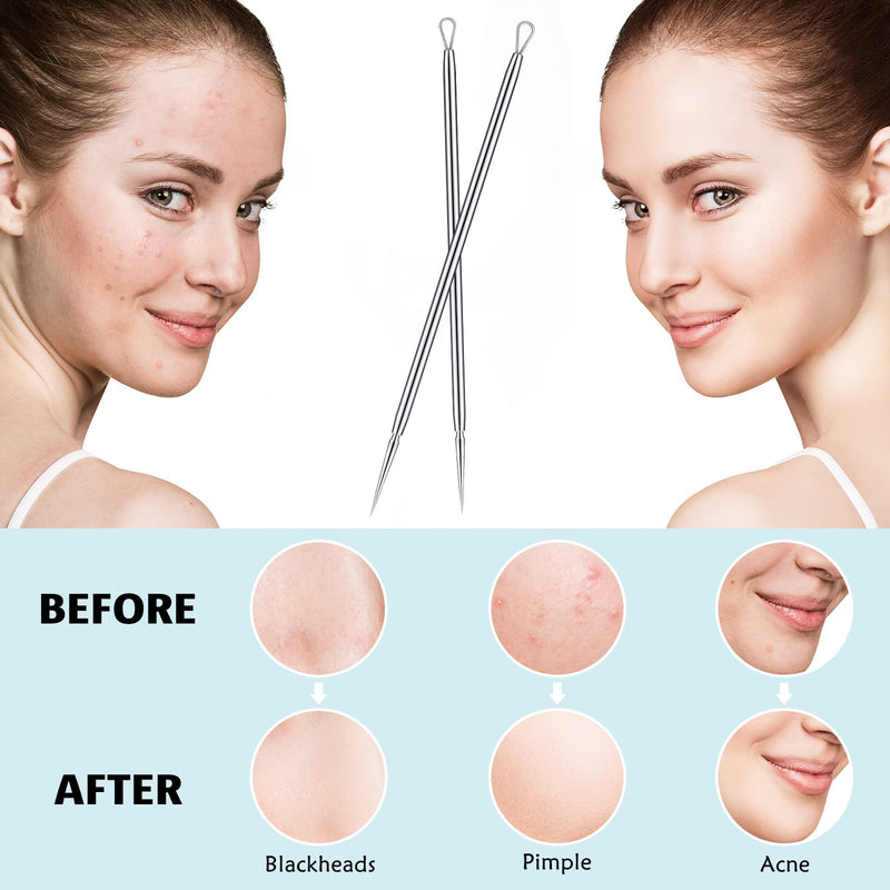 [Australia] - 2 Pcs Titanium Lancet Needle Blackhead Remover Tool Pimple Popper Tool Kit Professional Facial Milia Removal Blackhead Extractor Tool Comedone Zit Whitehead Blemish Extraction Tools 