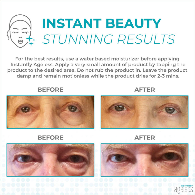 [Australia] - INSTANTLY AGELESS - Facelift In A Box Anti-Aging Face Cream for Forehead Wrinkles, Eyebrows, and Under-Eye Bags (10 Vials)… 10-Vials 