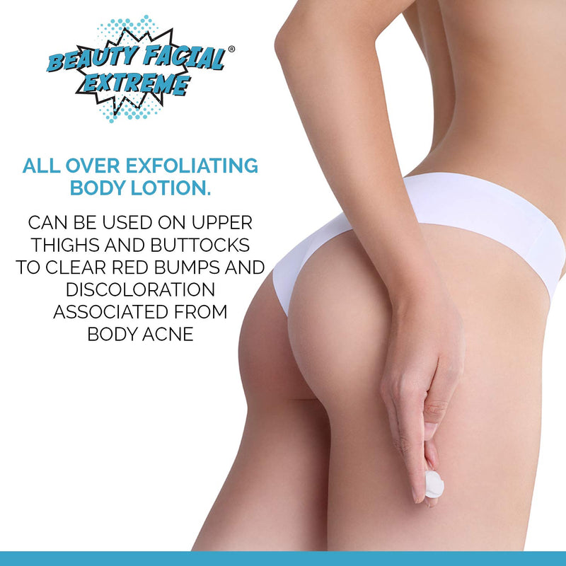 [Australia] - Exfoliating Body Lotion – 12% Lactic Acid Body Lotion. Provides Immediate Moisture & Gentle Exfoliation to Treat symptoms Associated with Keratosis Pilaris & Dry Skin Conditions. 