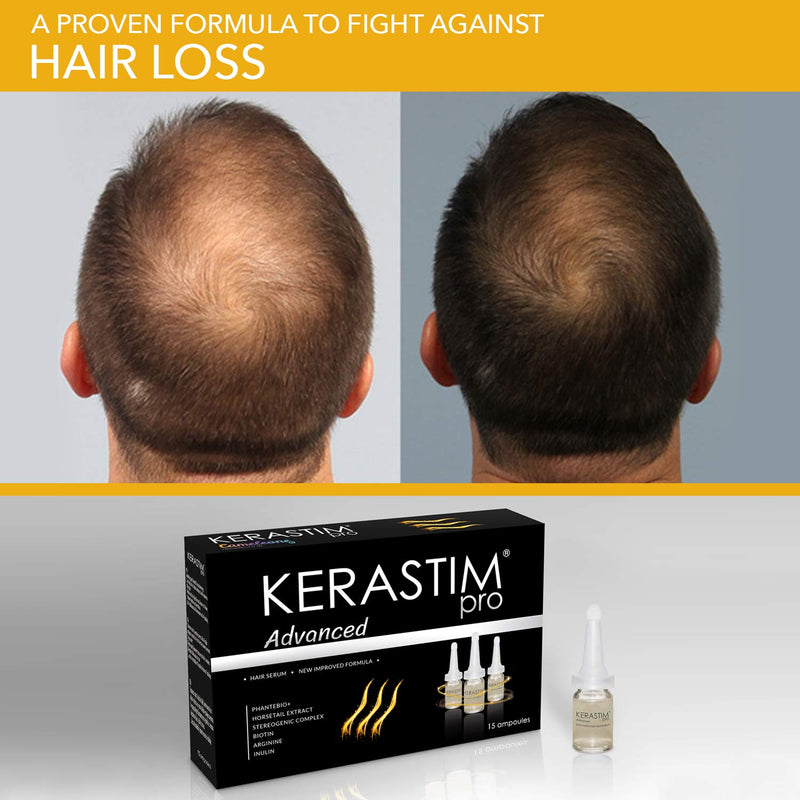 [Australia] - Kerastim Pro Hair Loss Treatment for Men & Women. Promote Hair Growth Serum, Anti-Thinning Formula. Helps Stop Hair Loss Fast & More Effective Than Shampoo. Keratin, Biotin, DHT Blocker 15 x 5ml 