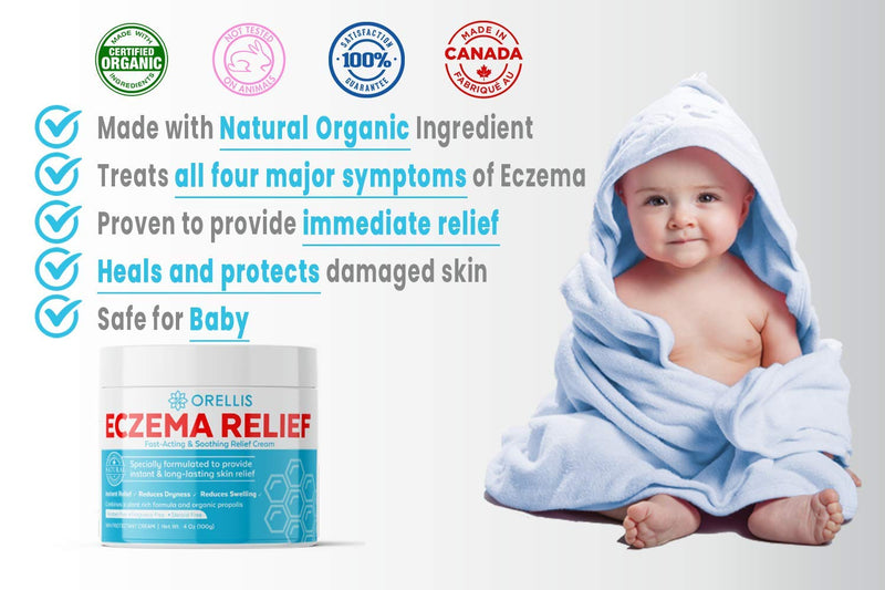 [Australia] - Orellis Natural Eczema Relief Cream with Calendula and Propolis. for Body & Face. Natural Cream for Eczema Relief & Dermatitis. Provides Itch Relief and Reduces Flare ups Caused by Eczema. 