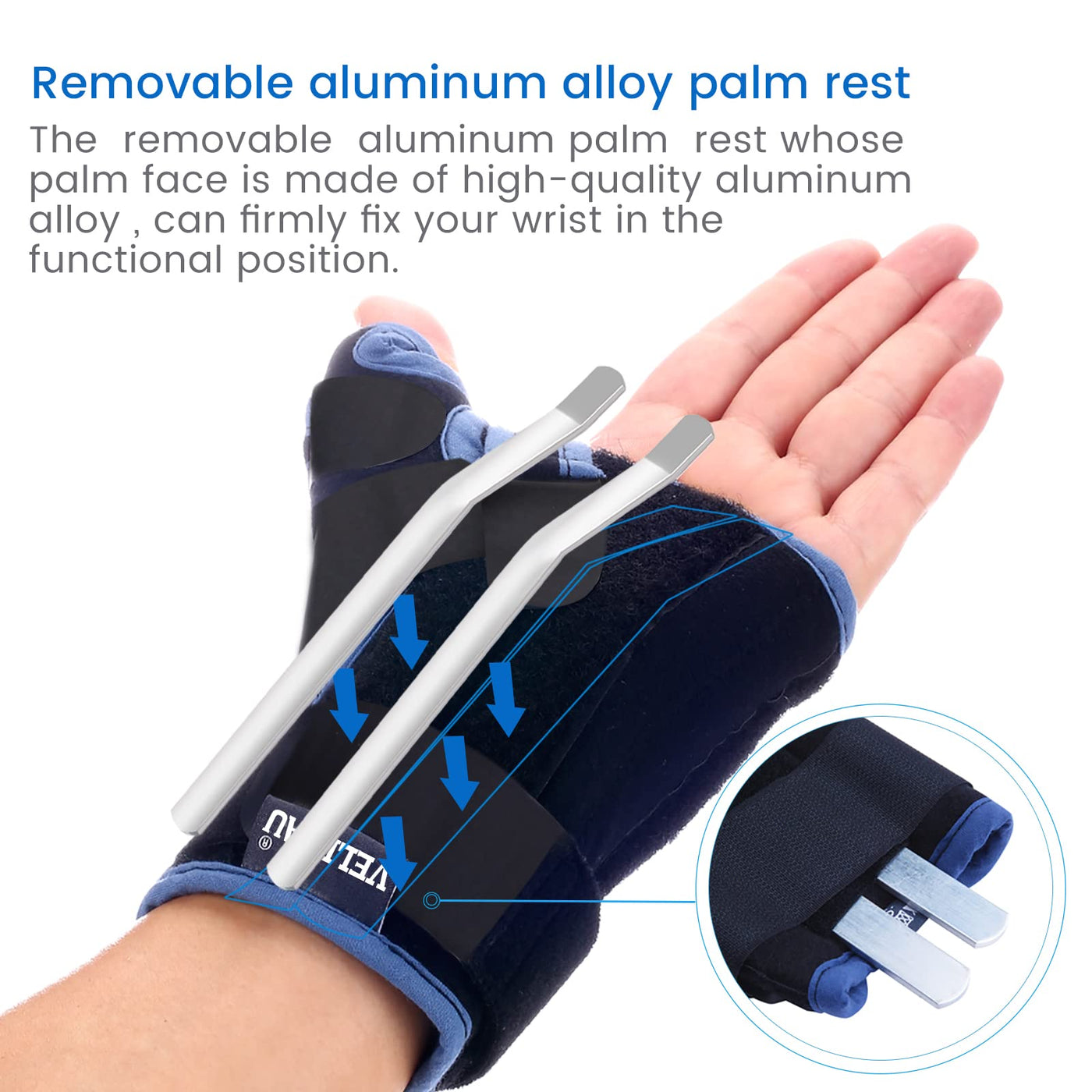  Velpeau Wrist Brace with Thumb Spica Splint for De Quervain's  Tenosynovitis, Carpal Tunnel Pain, Stabilizer for Tendonitis, Arthritis,  Sprains & Fracture Forearm Support Cast (Regular, Left Hand -L) : Health 