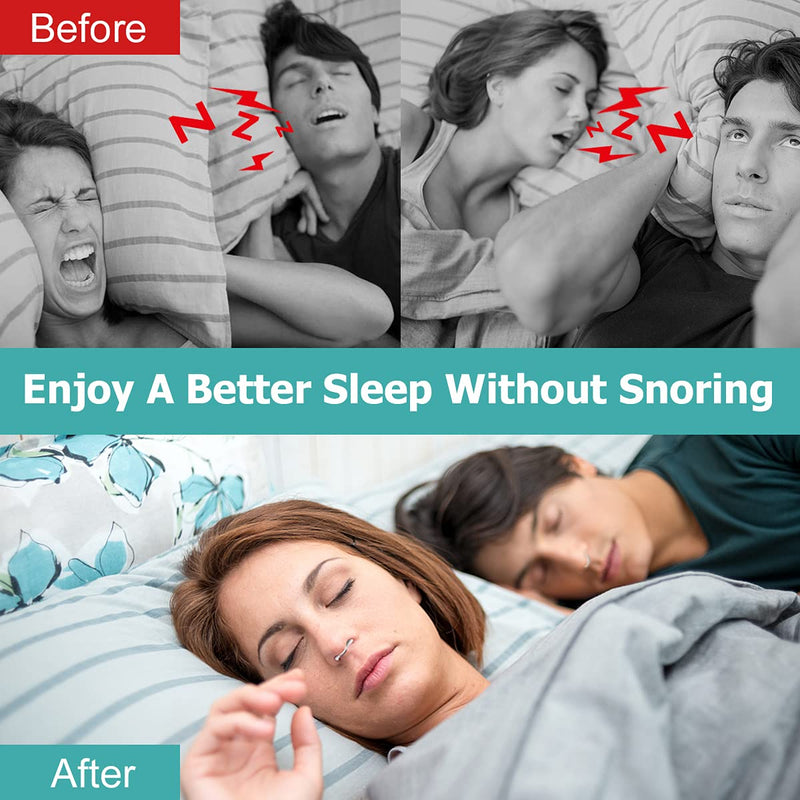 [Australia] - 2023 Upgrade Anti Snoring Nose Vents, 8 Set Snoring Solutions Anti Snoring Stopper Nose Vents Nasal Dilators Snore Reducing Snore Stopper Advanced Snore Anti-Snoring Devices Snore Reducing Aids 