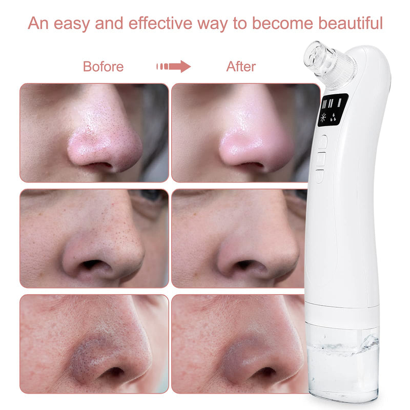 [Australia] - Boobeen Blackhead Remover Vacuum - Electric Pore Cleaner with Hot Compress - USB Rechargeable Pore Extractor Blackhead with 3 Modes and 4 Probes - Blackhead Remover Tools for Women and Men WH1 