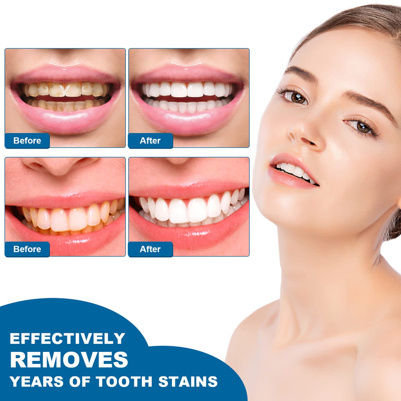 [Australia] - 2PCS Teeth Whitening Essence, Teeth Whitening Pen, Instant Teeth Stain Remover Pen, Teeth Whitening Essence Pen, Intensive Stain Removal Teeth Reduce Yellowing 