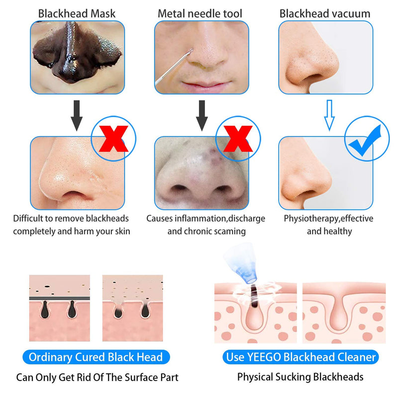 [Australia] - A FairyBell, Pore Vacuum Electric Blackhead Facial Suction Pore Cleaner Led Display Blackhead Remover 