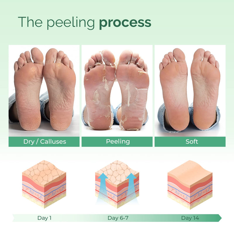 [Australia] - Foot Peel Mask with Peach by Plantifique - 1 Pack Foot Mask Dermatologically Tested - Repair Heels & Removes Dry Dead Skin for Soft Baby Feet - Exfoliating Foot Peel Mask for Hard Skin - Peeling 