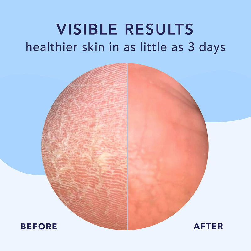 [Australia] - Barefoot Scientist High Dive Intensive Hydration Foot Therapy Cream, Specialized Moisture for Dry Feet and Cracked Heels 