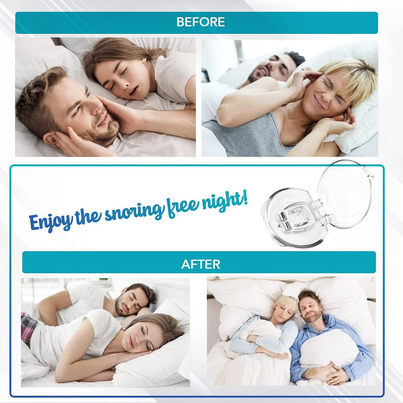 [Australia] - Skyloa Anti Snoring Devices - Silicone Magnetic Anti Snoring Nose Clip, Snore Stopper, Provide Effective Snoring Solution - Comfortable Nasal to Stop Snoring(4 PCS) 