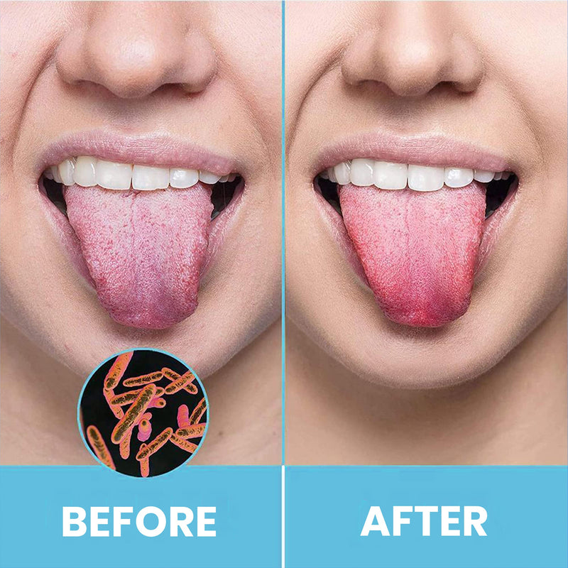 [Australia] - Tongue Scraper for Adults by HOKIN (2Pcs Oral Care Pack) Stainless Steel Tongue Cleaners Reduce Bad Breath 100% Metal Tough Scrapers Men and Women Hygiene Product 2 Count (Pack of 1) U Shaped Silver 