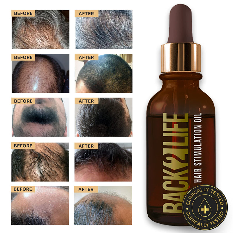 [Australia] - Back2Life 100% Natural Hair Stimulation & Beard Growth Oil-Get Rid of Patchy Beards & Hair-Beard serum to Moisturise, Hydrate & Condition-Repair & Rebalance Your Scalp & Regrow your Head & Beard Hair 