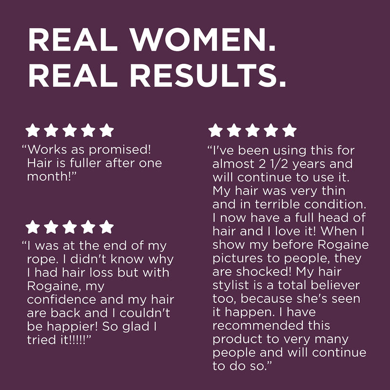 [Australia] - Women's Rogaine 5% Minoxidil Foam for Hair Thinning and Loss, Topical Treatment for Women's Hair Regrowth, 2-Month Supply Women's Rogaine 5% 2 Month 