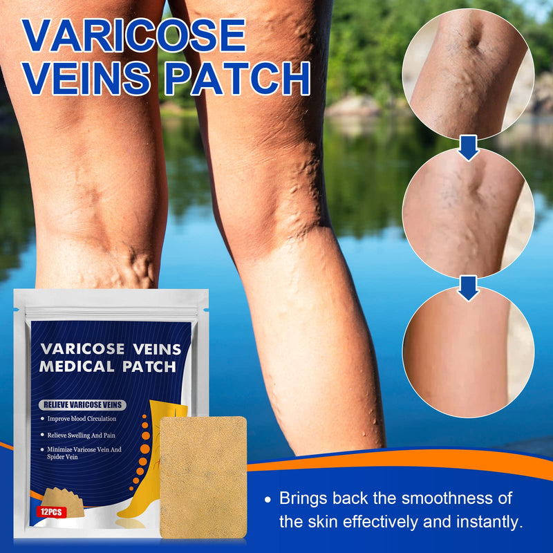 [Australia] - Varicose Veins Treatment for Legs, Varicose Veins Patch, Relief Leg Pain & Spider Varicose Vein, Strengthen Capillary Health & Improve Blood Circulation，36pcs 36pcs 