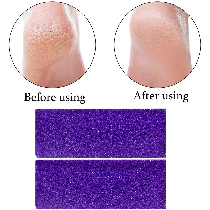 [Australia] - 40 Pcs Pumice Stone For Feet Foot Scrubber Sponge For Feet Care and Callus Remover Mini Disposable Pumice Pads For Dead Skin Remover Purper. 