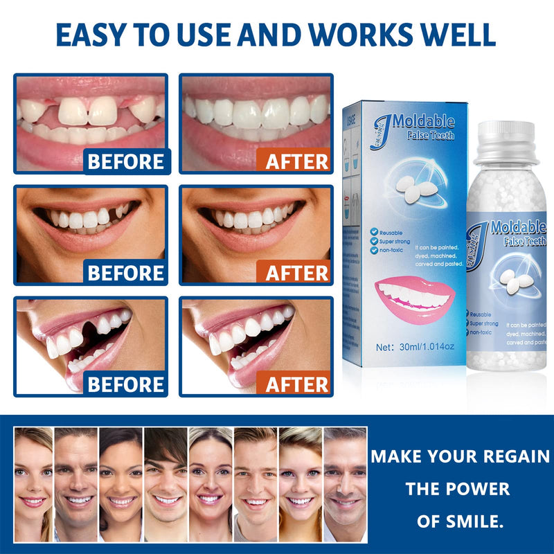 [Australia] - Moldable False Teeth Tooth Repair Granules, Teeth Repair Kit, DIY Temporary Tooth Repair Beads, for Temporary Fixing The Missing and Broken Tooth Replacements, 30ml (BLUE) 