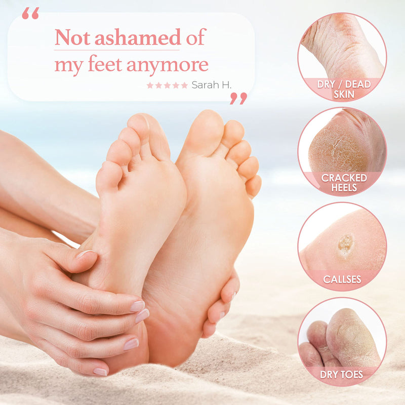 [Australia] - Foot Peel Mask - For Cracked Heels, Dead Skin & Calluses - Makes Your Feet Baby Soft - Removes & Repairs Rough Heels, Dry Toe Skin - Exfoliating Peeling Natural Treatment (3 Pack, Women's 5-11) Women's 5-11 (3 Pack) 