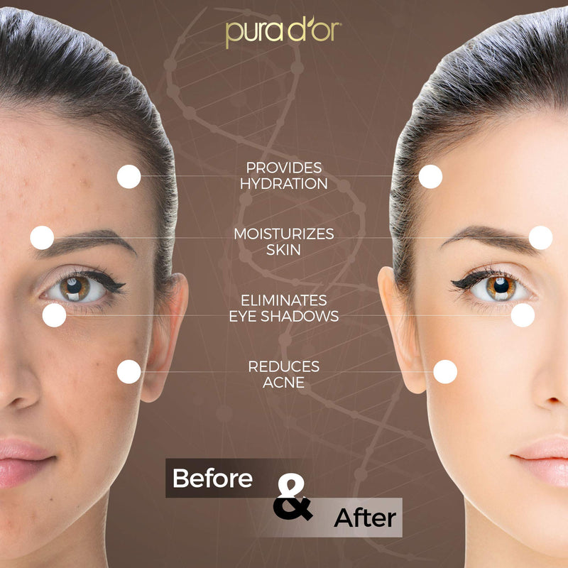 [Australia] - PURA D’OR Tamanu Oil (4oz / 118mL) USDA Organic Certified 100% Pure Natural Hexane Free Premium Grade Moisturizer - Helps Reduce Appearance of Scars from Psoriasis, Eczema & Acne (Packaging may vary) 