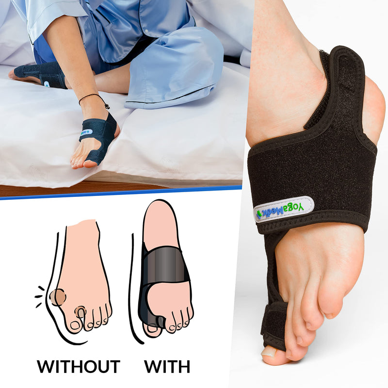 [Australia] - Bunion Corrector Big Toe Straightener - 2x Bunion Splints, 2x Silicone Bunion Correctors - Adjustable, Day & Night Support Kit 