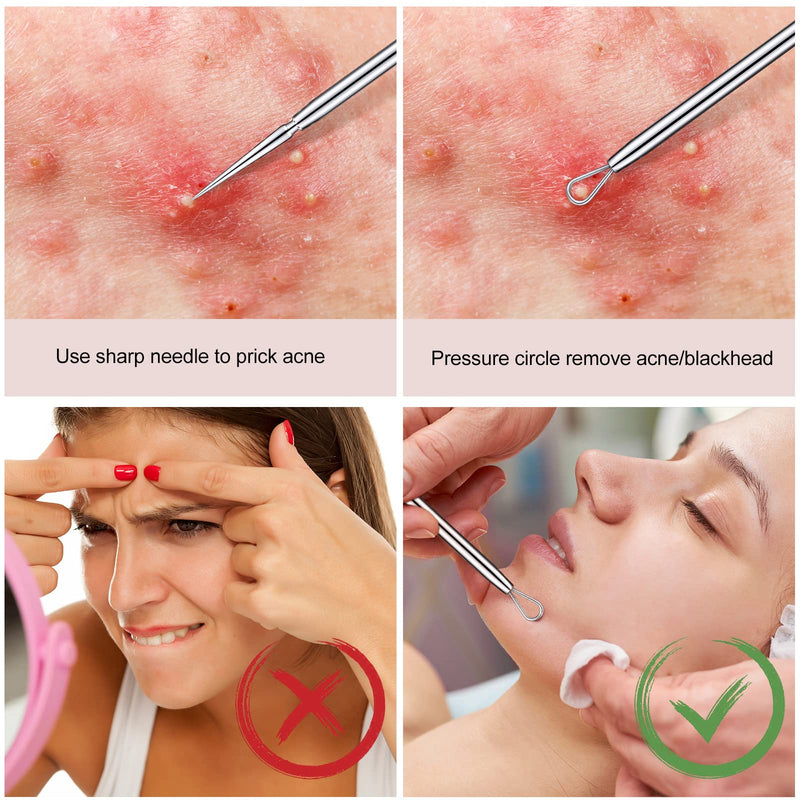 [Australia] - 2 Pcs Titanium Lancet Needle Blackhead Remover Tool Pimple Popper Tool Kit Professional Facial Milia Removal Blackhead Extractor Tool Comedone Zit Whitehead Blemish Extraction Tools 
