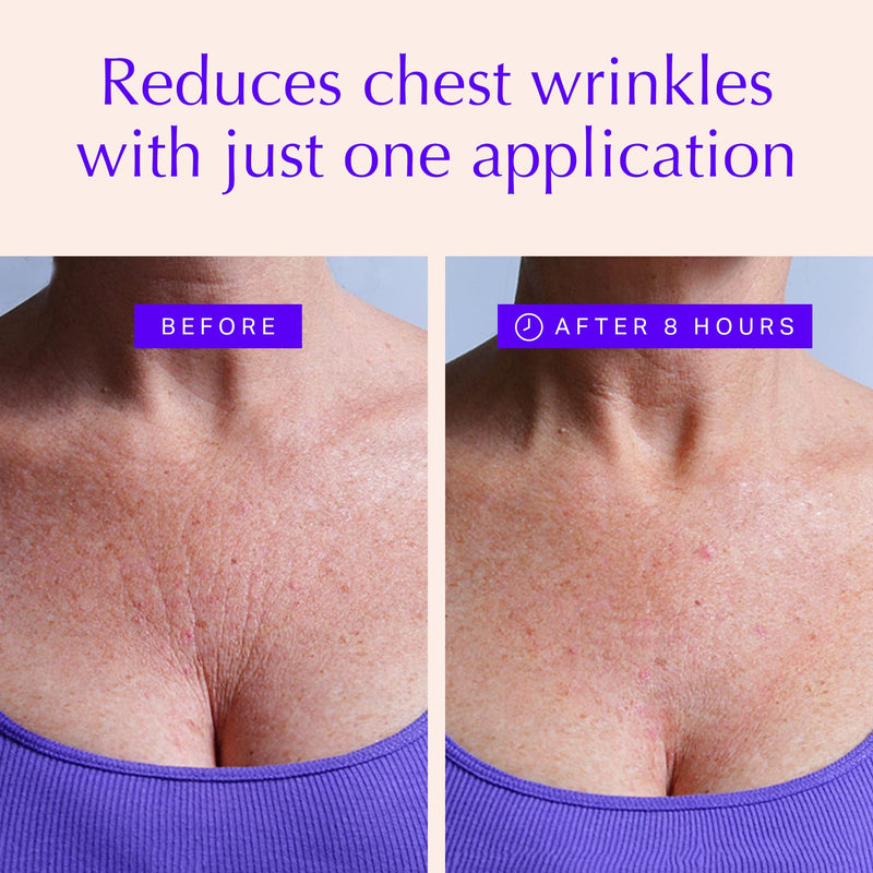 [Australia] - Chest Wrinkle Pads - Anti-Ageing Advanced Skin Firming Tightening & Moisturizing Treatment - Skin Safe Silicone Patches - Reusable Overnight Lift for Crepe Erase - Neck & Décolleté (1-mo Supply) 2 Chest Pads | Best Seller for Chest Wrinkle Pads 