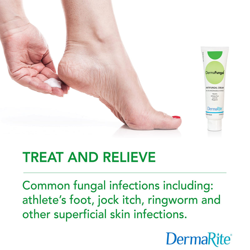 [Australia] - DermaFungal Antifungal Cream - Treats and Prevents Most Athlete’s Foot, Jock Itch, and Ringworm - 2% Miconazole Nitrate – 3.75 oz Tube 3.75 Ounce (Pack of 1) 
