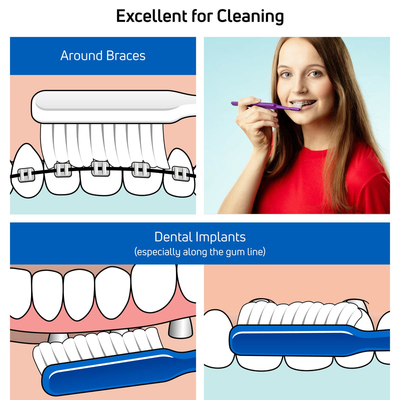 [Australia] - TEPE Implant/Orthodontic Brush / For Cleaning Near Implants And Orthodontic Wires / 1 X Implant And Orthodontic Brush 