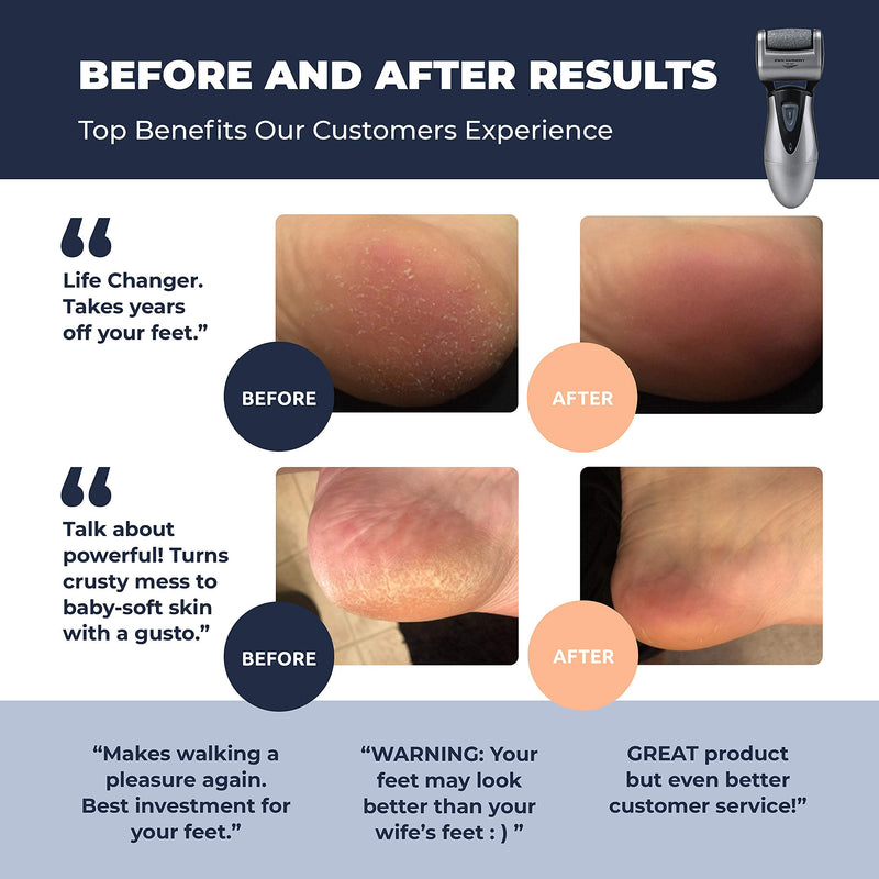 [Australia] - Electric Foot Callus Remover, Feet Scrubber: Own Harmony Rechargeable Mens Pedicure Tools Kit, Professional Electronic Foot Care File, Best for Hard Cracked Dead Skin and Powerful Pedi Spa, 3 Rollers Gray 